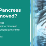 What Happens If Your Pancreas Is Removed?