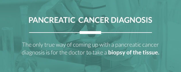 pancreatic cancer detection